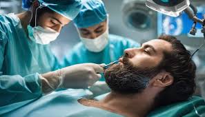 Beard Hair Transplant