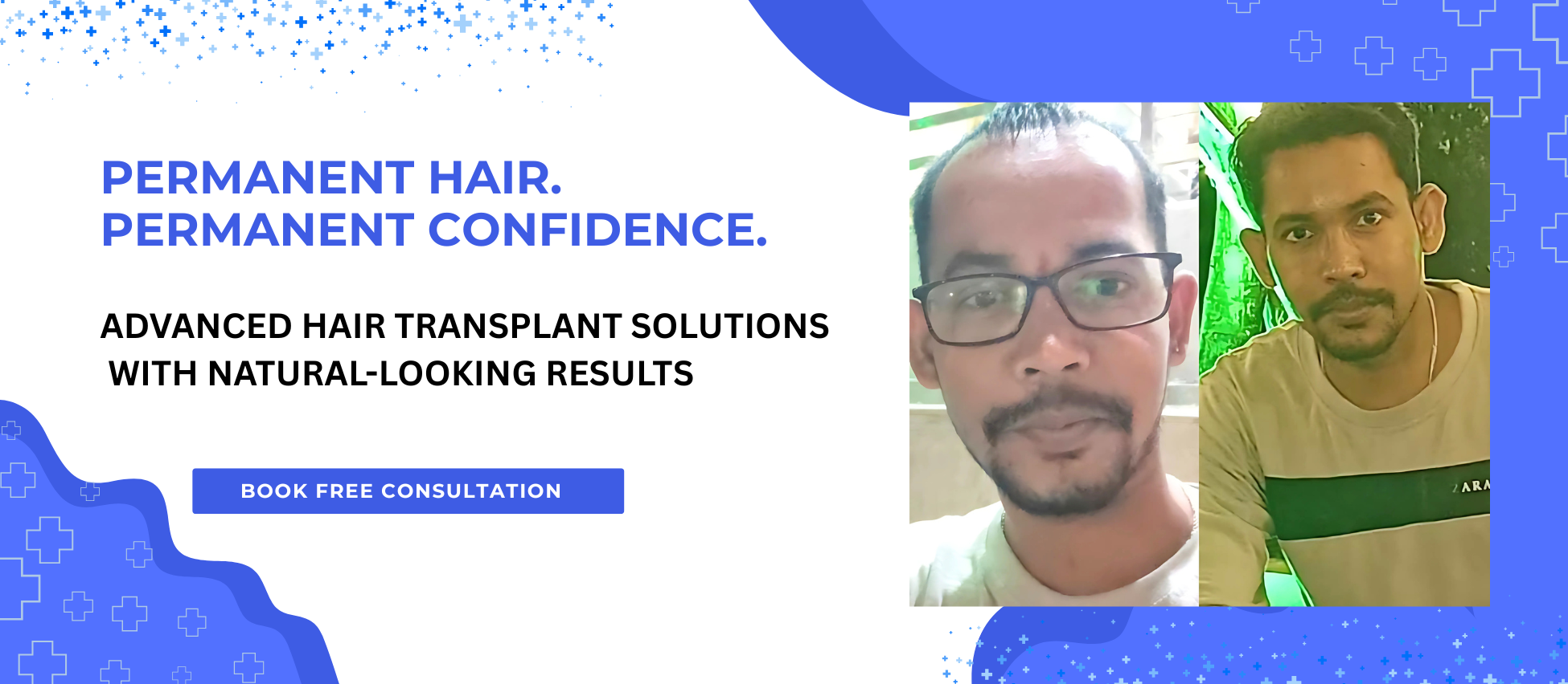 Banner 3 - Hair wigs / results